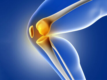 Joint-Replacement-4